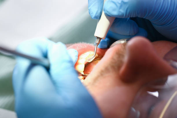 Best Urgent Dental Care for Toothache in Pocola, OK